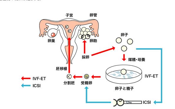 供卵移植成功率_供卵移植成功率:如何提高成功率?