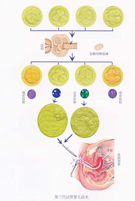 供卵的孩子-供卵宝贝：以孩子为中心的故事”