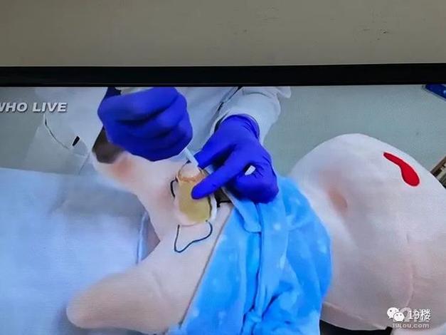 供卵试管代怀男孩过程【男孩供卵试管代怀全过程解析”】